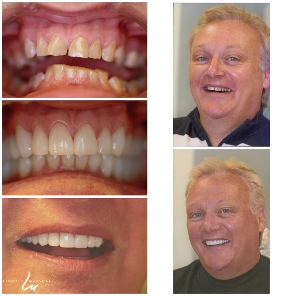 patient case before and after