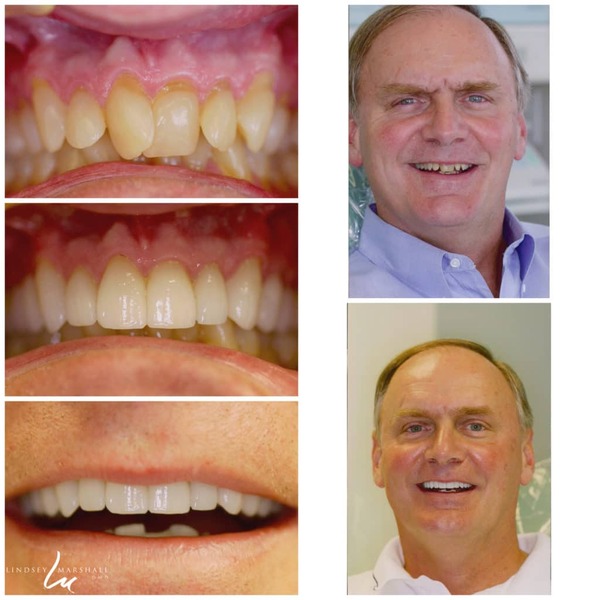 patient case before and after